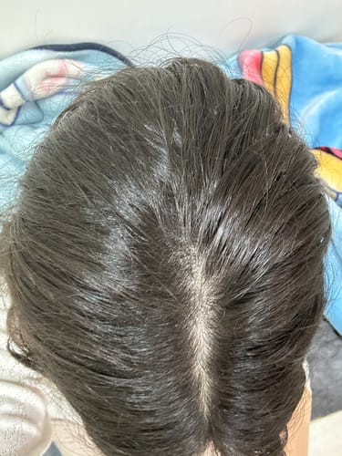 תקריב של שיערה וקרקפתה של לקוחה לאחר שימוש ב-Fill it Hair.