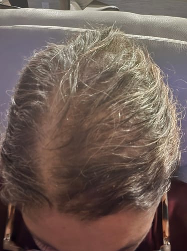 Customer photo review of Miracle Hair Growth Oil