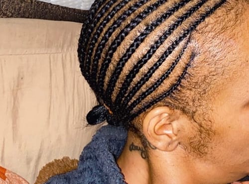 Customer photo review of Minoxidil 5% Solution, 1 Pack 60ml