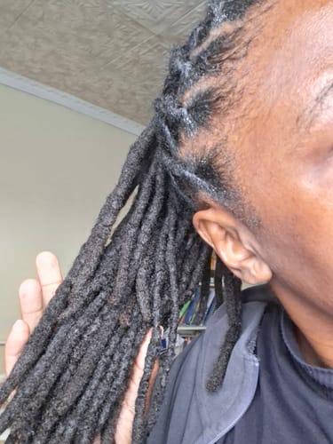 Customer photo review of Minoxidil REGULAR (2%) strength FOAM, 1x60ml pack