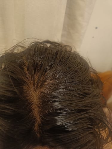 Customer photo review of Seb Natural Calming Serum