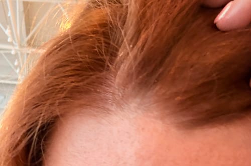 Customer photo review of Seb Natural Calming Serum