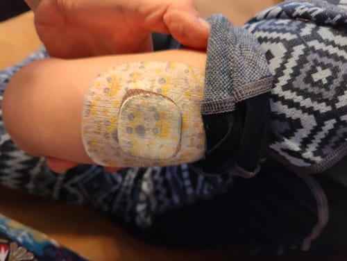 Customer photo review of Simplera Sensor Patch - Patch Me UP ! Childhood Memories