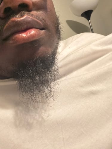 Customer photo review of Beard Care Kit