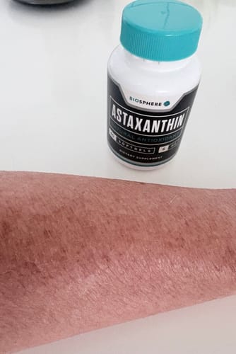 Customer photo review of Astaxanthin