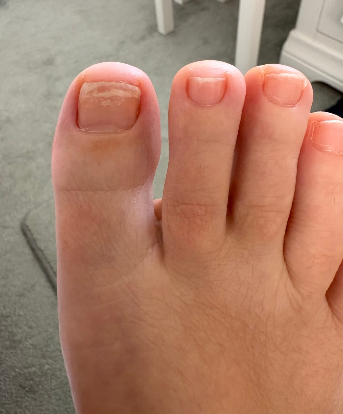 Customer photo review of Fungal Freedom