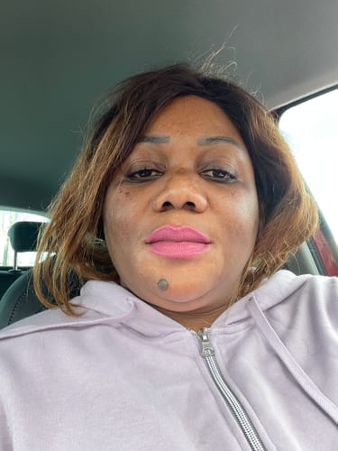 Customer photo review of DERMA CLEAR WASH