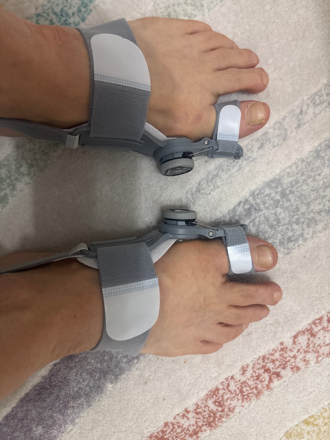 Customer photo review of Foot Medikal