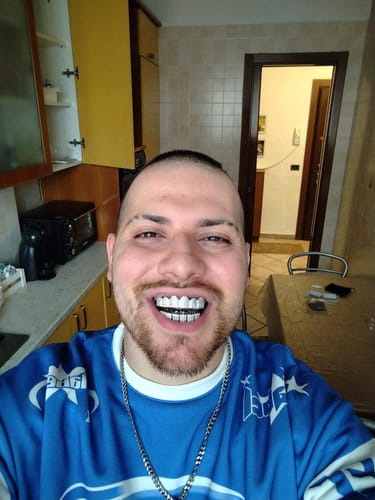 Customer photo review of Grillz Ice Storm - Silver