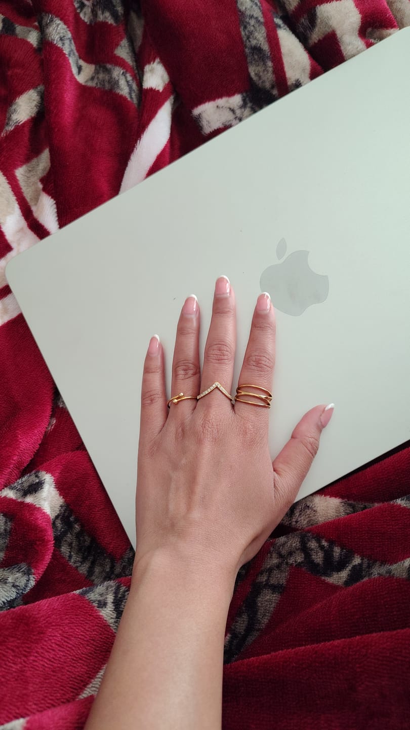 Customer photo review of Twist Cross Cage Ring