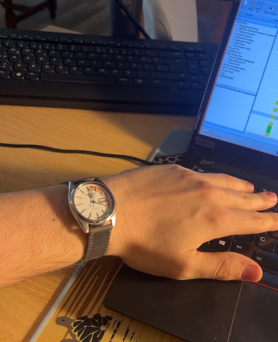 Customer photo review of Klasik Saat Deri Kordon Saat Kayışı Gri - Crazy