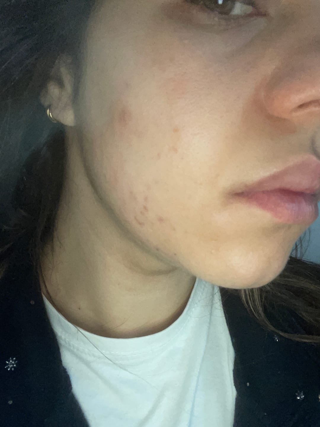 Customer photo review of A CONTROL + CORTIZEN - Equilibrio hormonal desde el cerebro, los ovarios, la piel y el metabolismo.