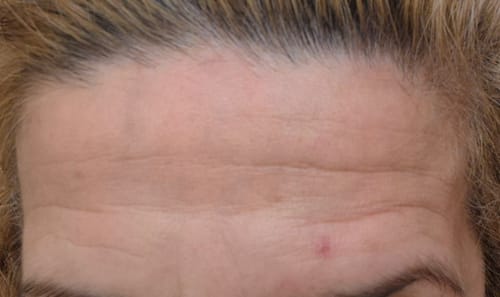 Customer photo review of Miyora 24K Micro-Infusion Ritual