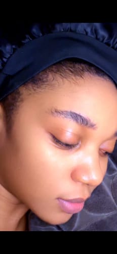 Customer photo review of Minoxidil High Strength (5%) SOLUTION, 3x60ml pack