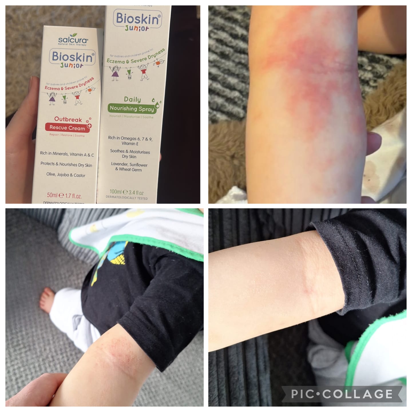 Customer photo review of Bioskin Junior Duo Pack