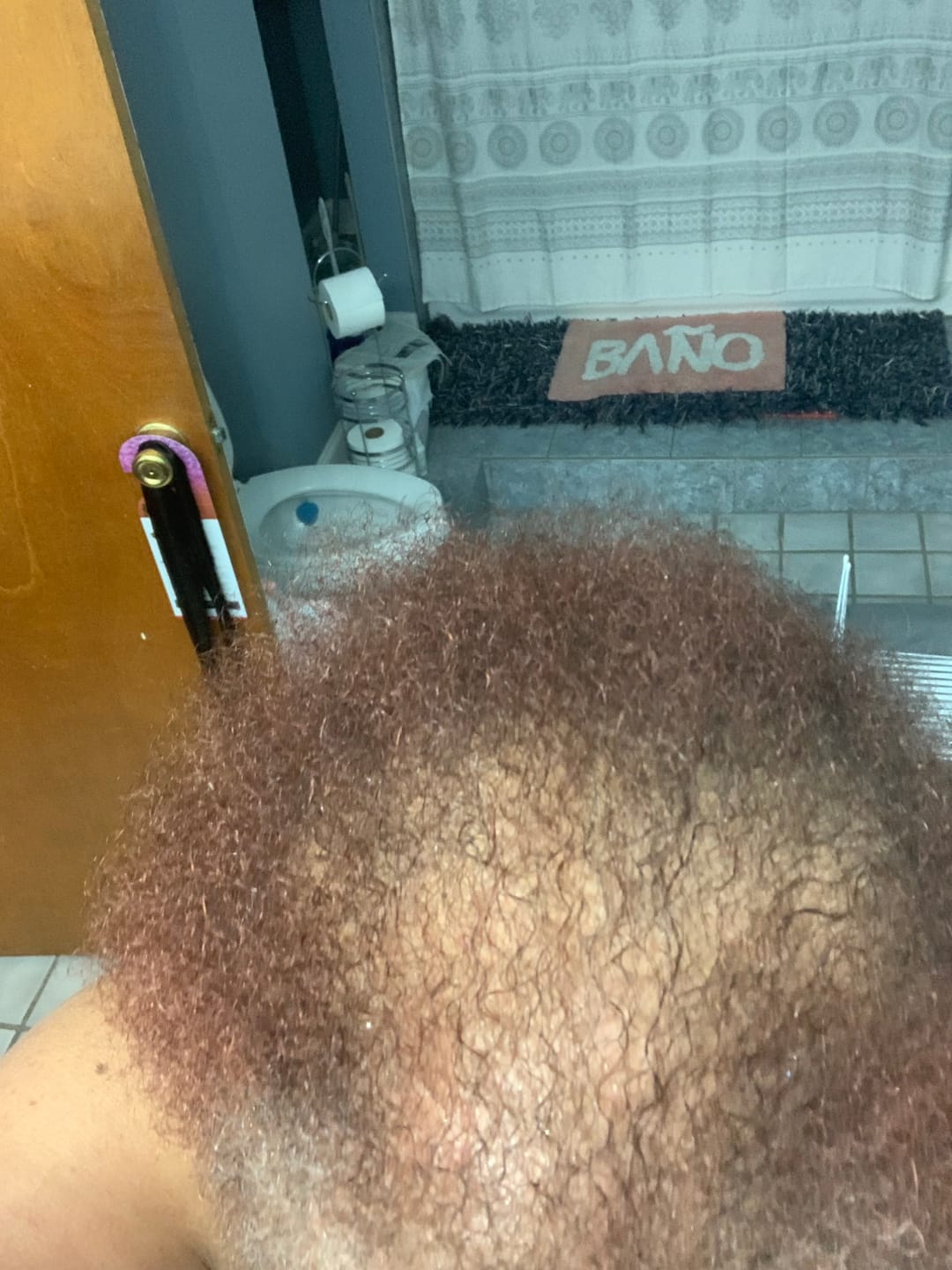 Customer photo review of “The Original” Hair Flourishing Capsule