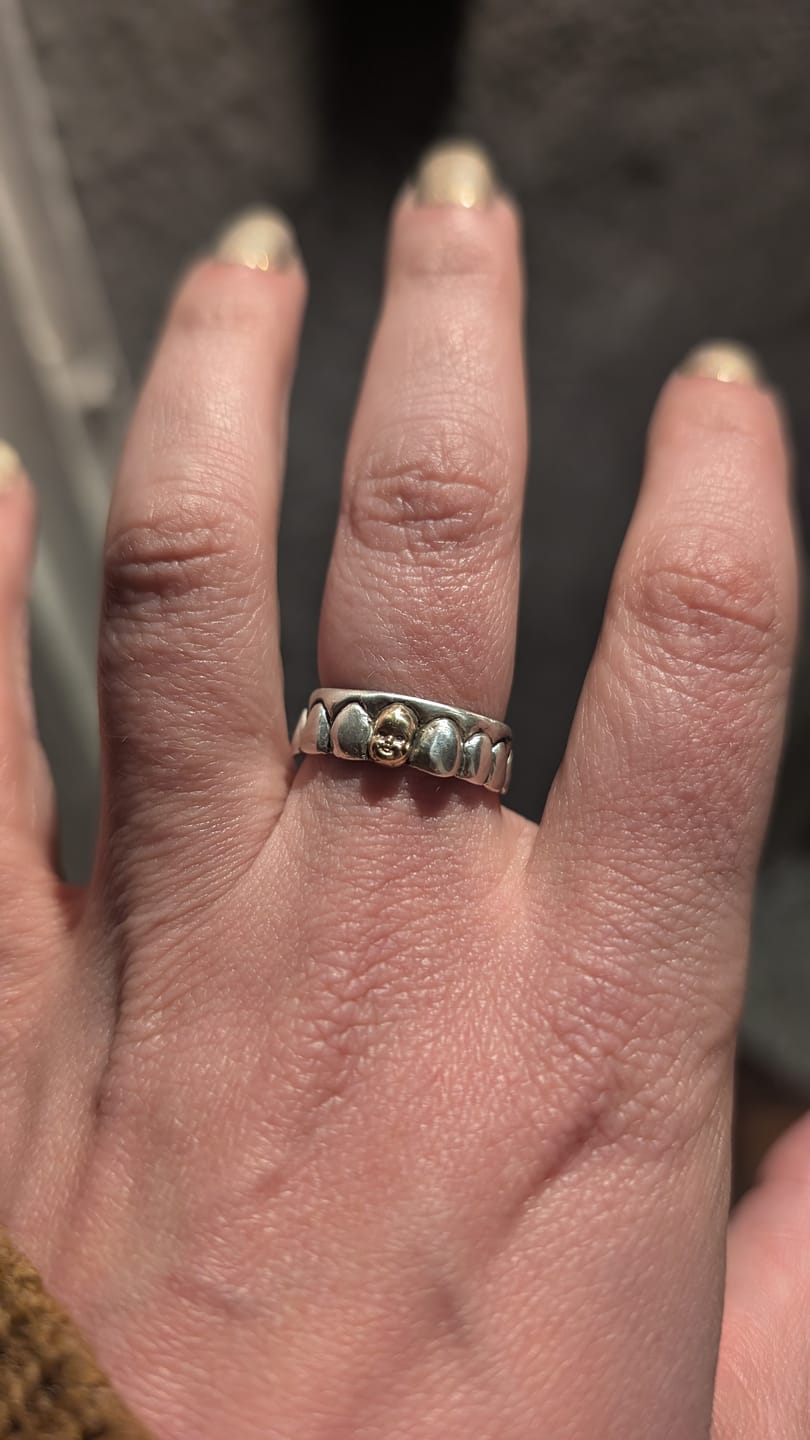 Customer photo review of Gold Baby Head Tooth Ring