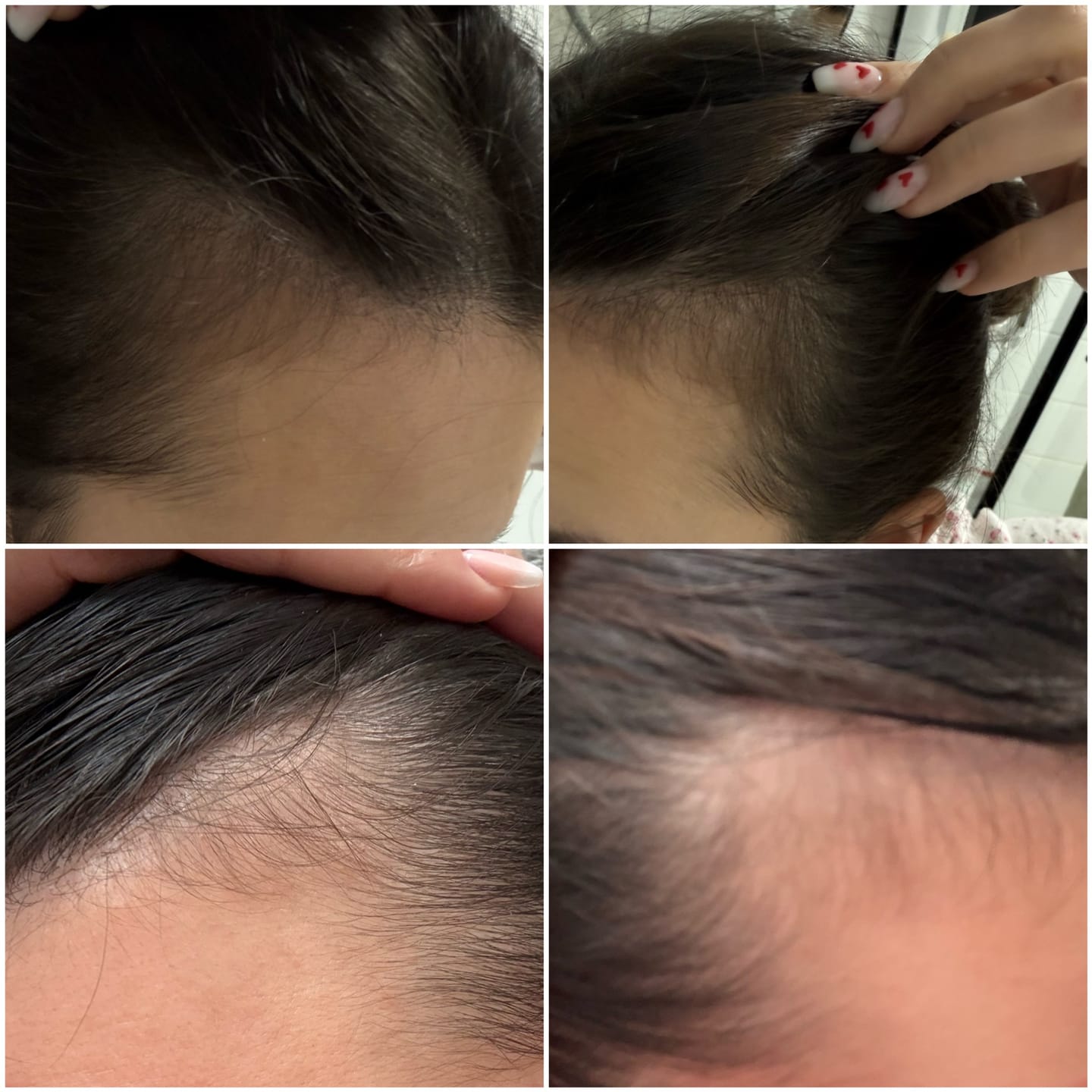 Customer photo review of HAARSERUM