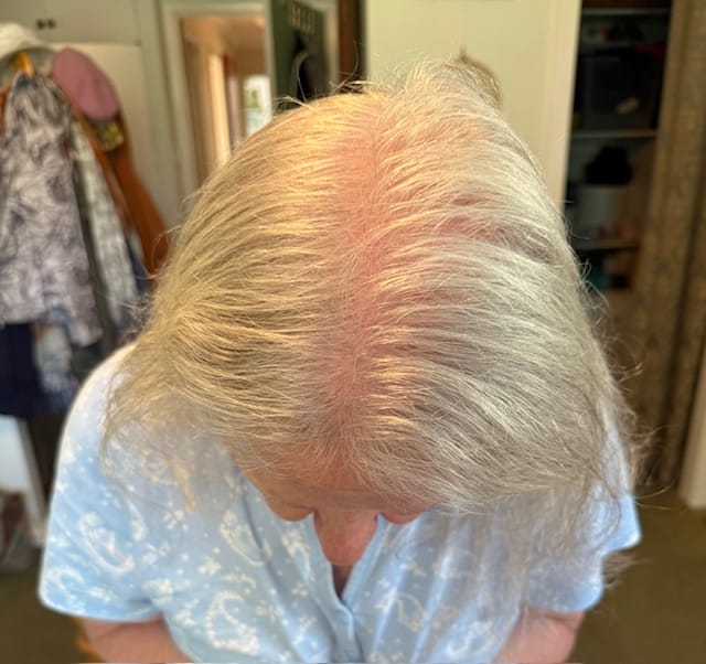 Customer photo review of PEPTIDE-POWERED HAIR SERUM