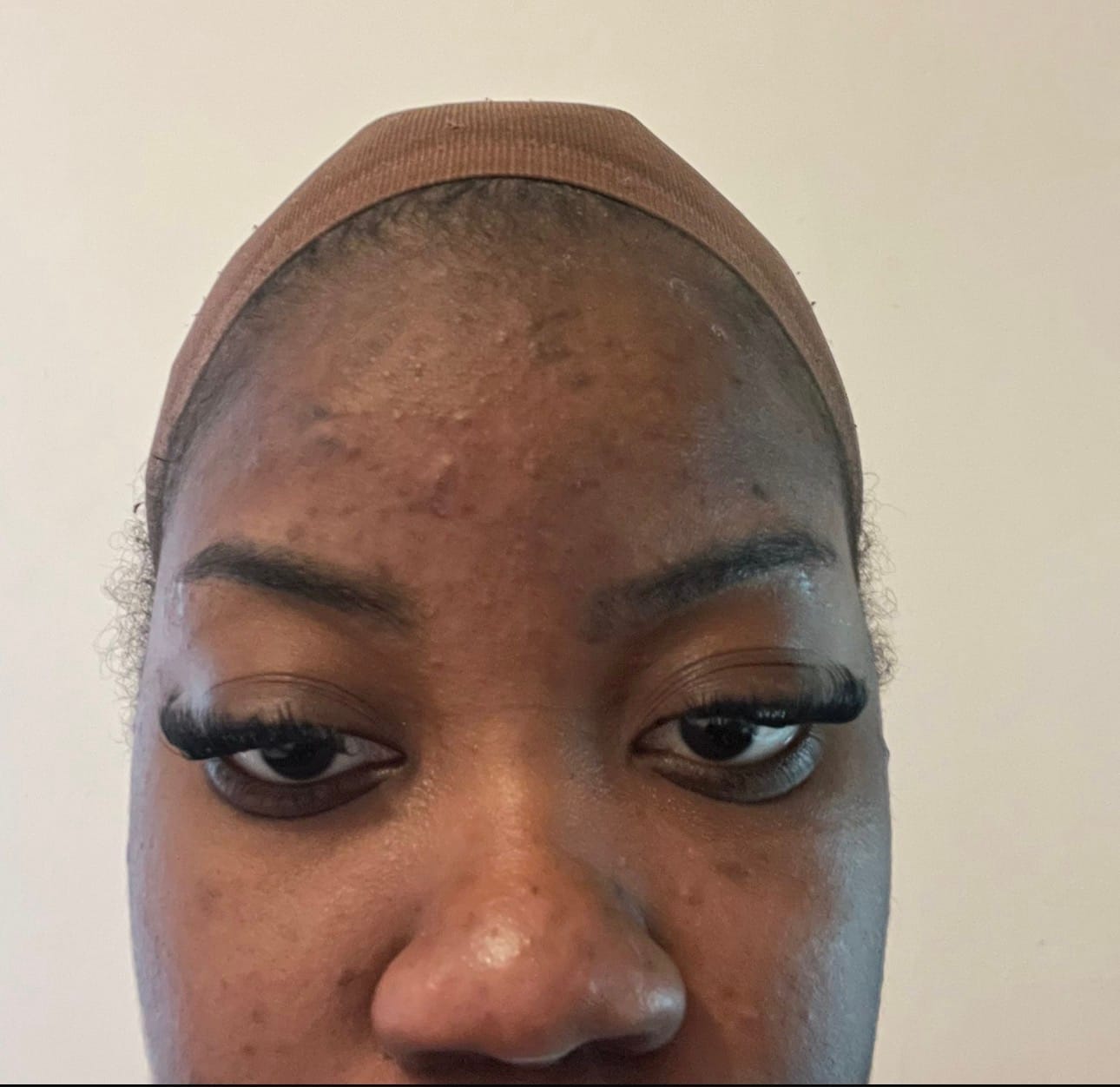 Customer photo review of GOMMAGE SUPER ÉCLAIRCISSANT AU CURCUMA CONTRE L'HYPER PIGMANTATION ET ANTI-QUINTO