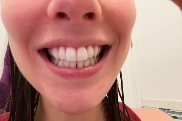 Customer photo review of Dental - Rife+ Frequency Protocols