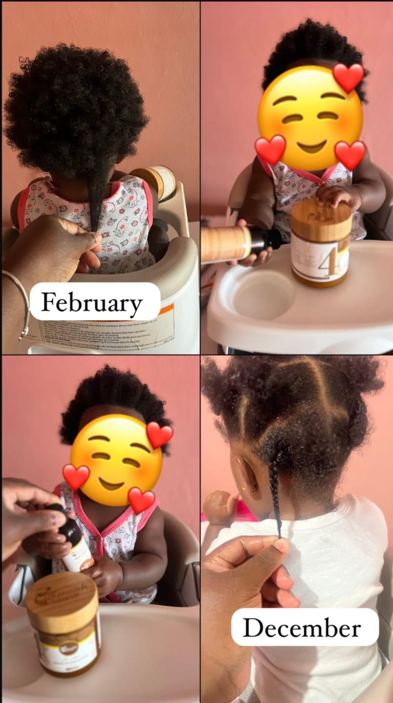 Customer photo review of Infused Ze Oil – Herbal Nourishing Scalp Blend