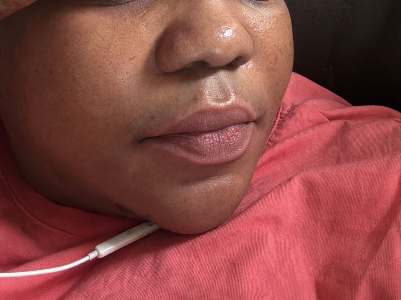 Customer photo review of BAUME À LÈVRE ROSE PERMANENT