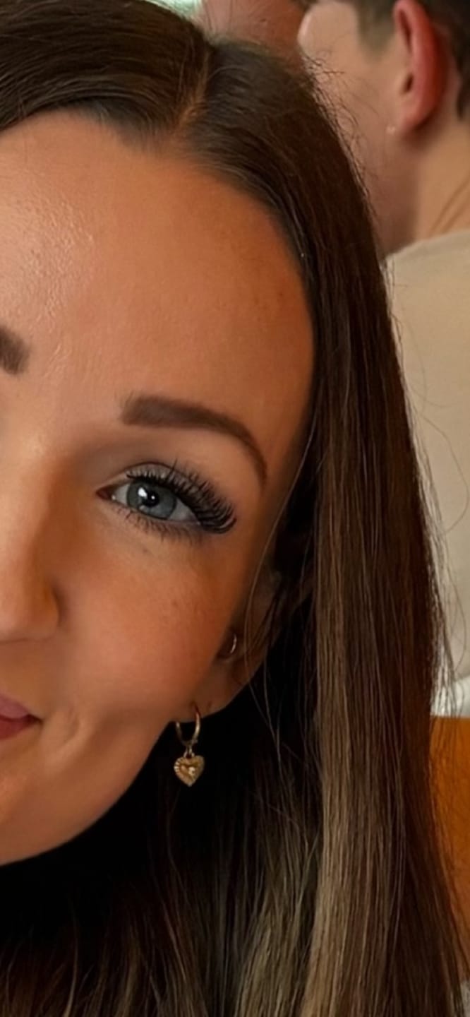 Customer photo review of Infinaluxe Dual-Sided Long Wear Lash Bond