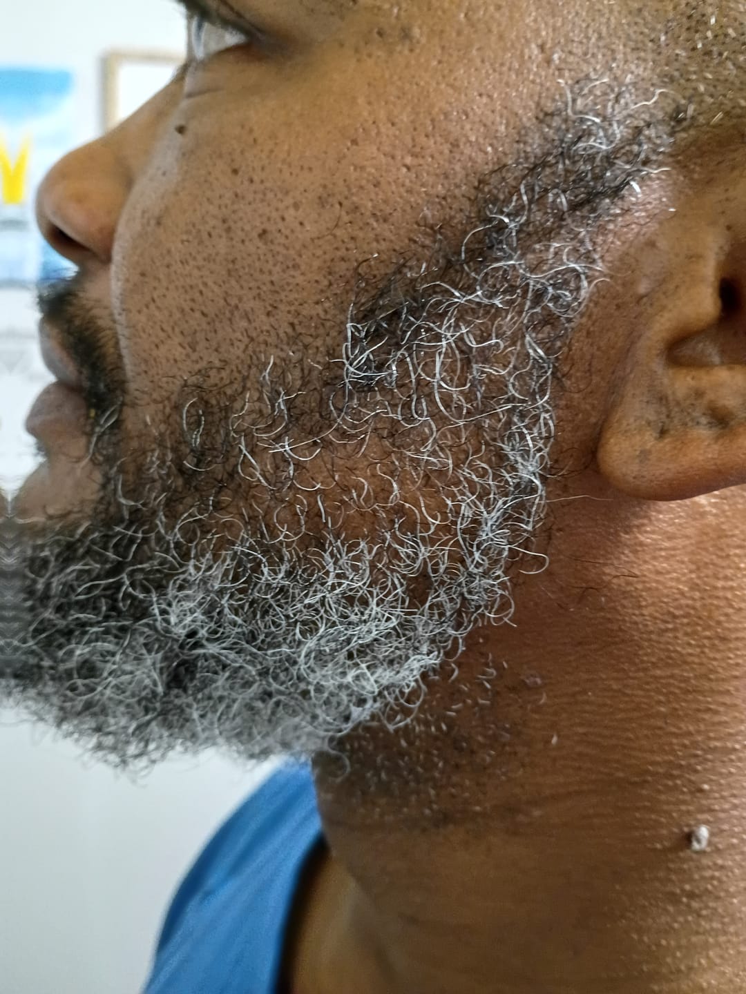 Customer photo review of Men’s Healthy Hair and Beard Starter Kit