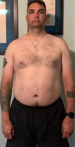 Customer photo review of Lymphdrainage