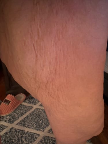 Customer photo review of Besque® Magic Body Oil - 100ml