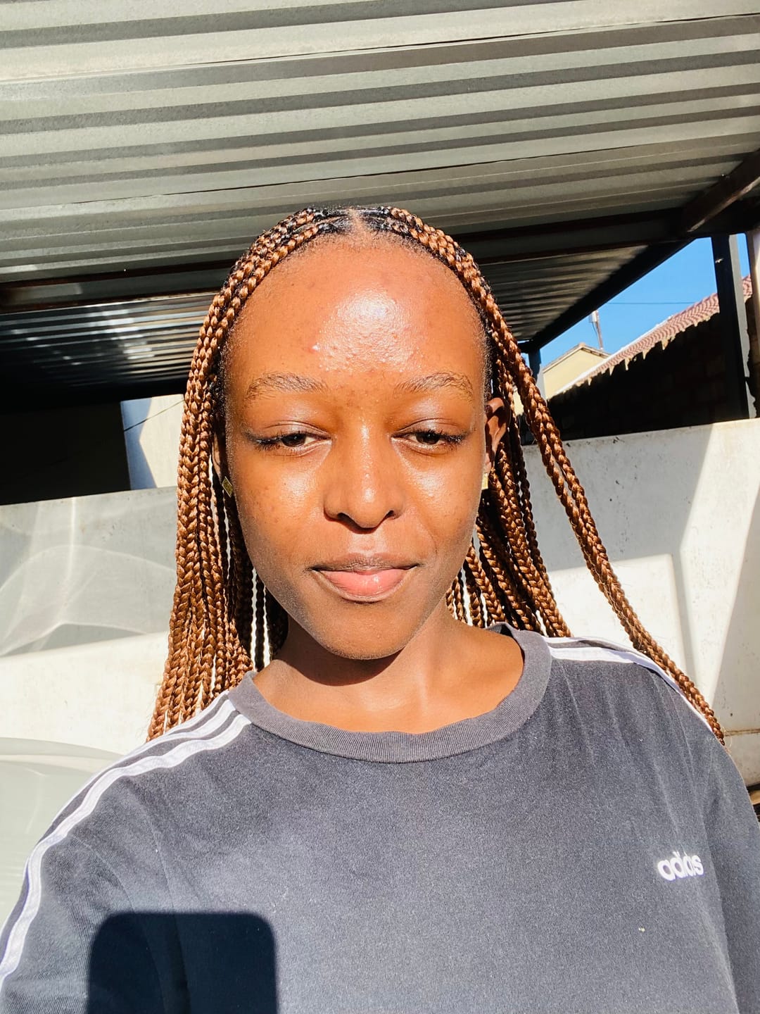 Customer photo review of Gmaeum Acne Capsules