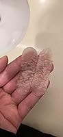 Customer photo review of 20CT Large Hydrocolloid Pimple Patches Hydrocolloid Patch Acne Spot Treatment