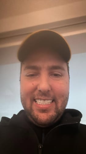 Customer photo review of Teeth-Veneer 3.0