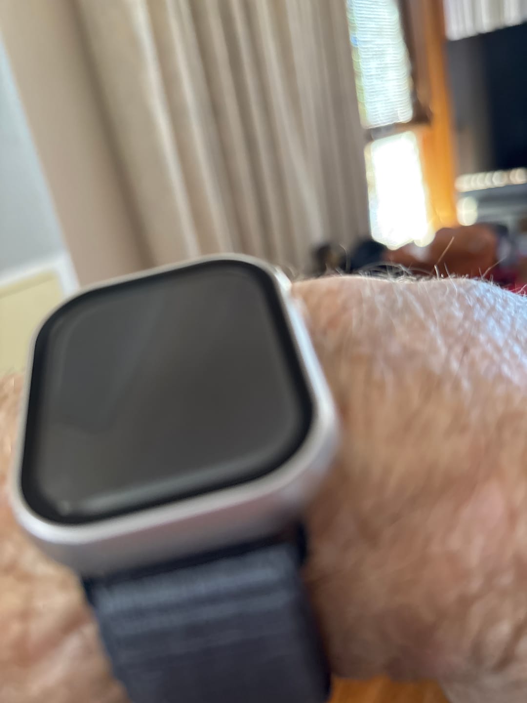 Customer photo review of All-in-one classic Apple Watch Protection Case