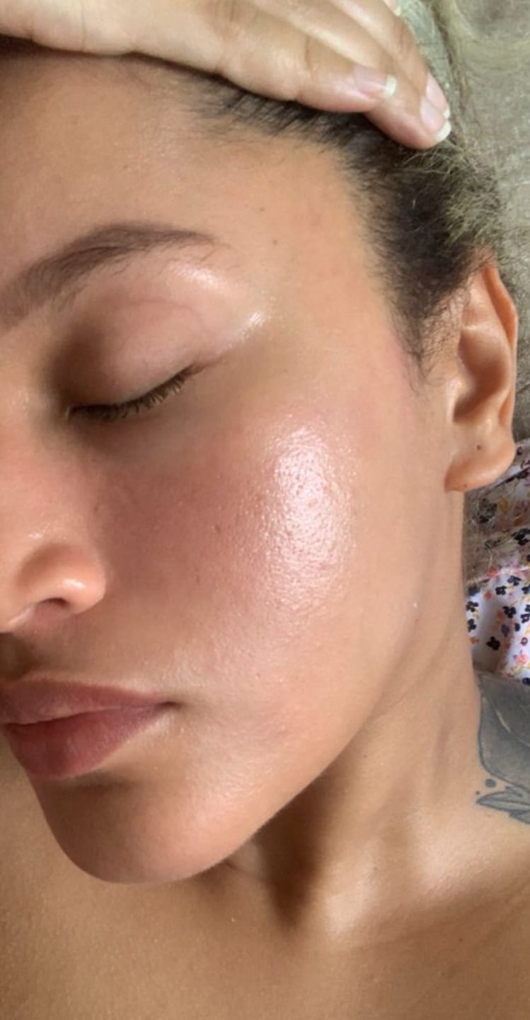 Customer photo review of Advanced Multi 7 Peptide + GHK-CU Copper Peptide Complex Serum