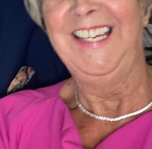 Customer photo review of CHARITY EDITION: Original Mint x Teenage Cancer Trust (x4)