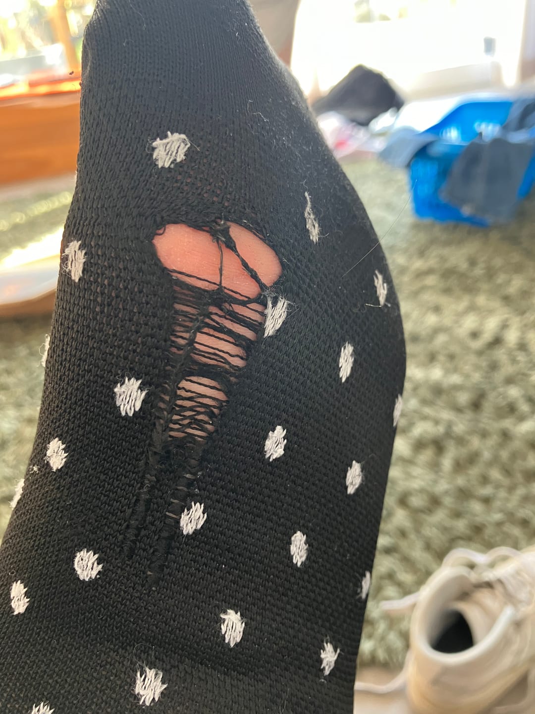 Customer photo review of Orthopädische Kompressionsstrümpfe Mix