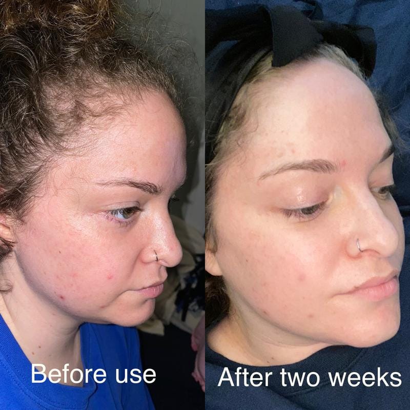 Customer photo review of Advanced Multi 7 Peptide + GHK-CU Copper Peptide Complex Serum