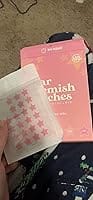 Customer photo review of 240 CT Pink & Clear Superstar Pimple Patches Hydrocolloid Patch Spot Treatment with Salicylic Acid & Tea Tree Oil