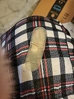 Customer photo review of 50CT Large Pimple Patches Hydrocolloid Patch Spot Treatment