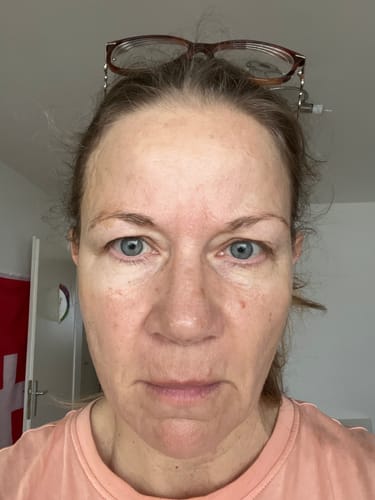 Customer photo review of Miyora 24K Micro-Infusion Ritual
