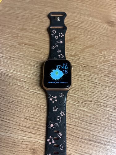 Customer photo review of Apple Watch Silikonband 'Dianne'