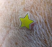 Customer photo review of 240ct Bright Blossoms Pimple Patches Hydrocolloid Patch Spot Treatment