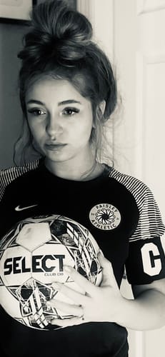 Customer photo review of 1.8% Salicylic Acid Drying Lotion