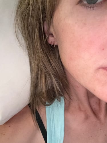 Close-up of a reviewer's calm face after using the Sea Buckthorn Serum to reduce redness and bumps.