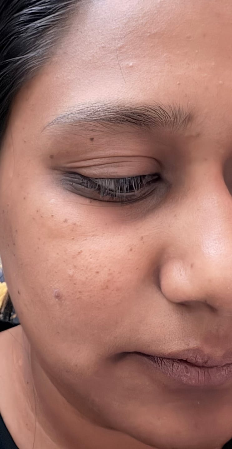 Customer photo review of Ujvala Skin Brightening Moisturizer