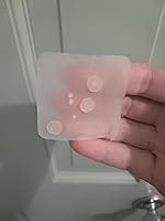 Customer photo review of 272 CT Variety Pack Pimple Patches Hydrocolloid Patch Spot Treatment