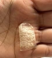 Customer photo review of 20CT Large Hydrocolloid Pimple Patches Hydrocolloid Patch Acne Spot Treatment