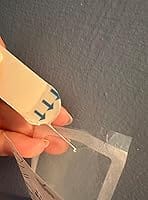 Customer photo review of 50CT Large Pimple Patches Hydrocolloid Patch Spot Treatment